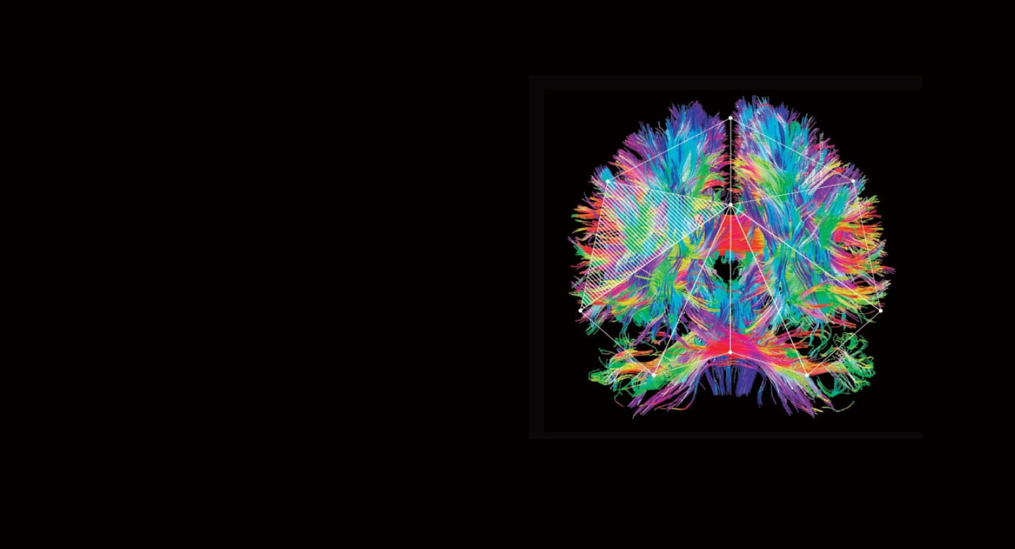 Brain illustration